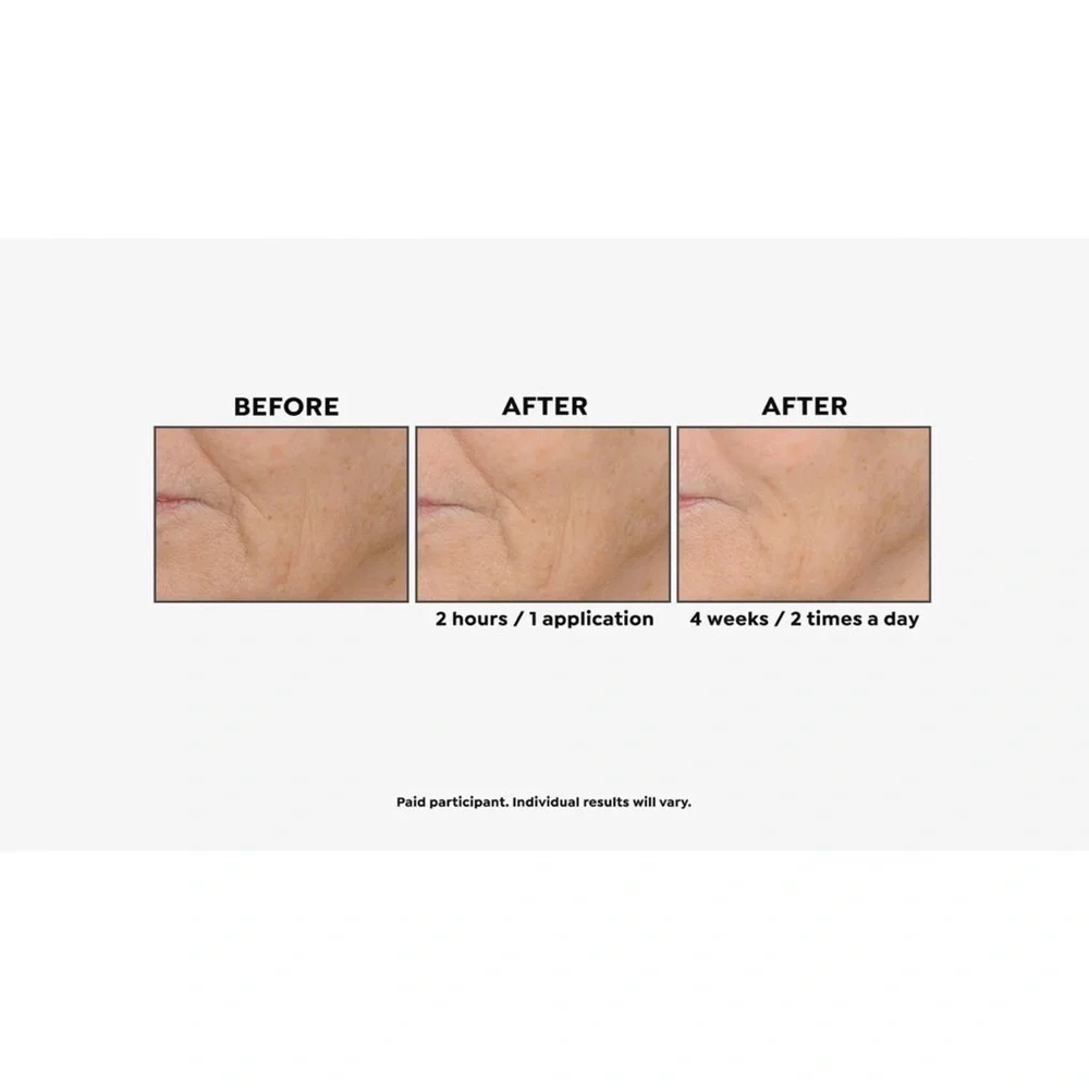 Perlier Black Rice Triple Size Hyaluronic Gel & Eye‎ Serum Auto-Ship®